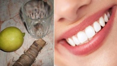 السر الطبيعي الفعال الذي يزيل اصفرار الأسنان بشكل نهائي