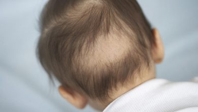 أسباب تساقط شعر الأطفال