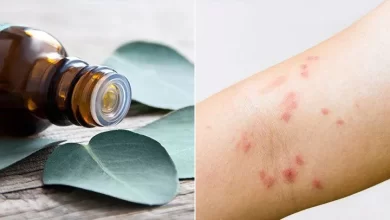 فوائد الزيوت الطبيعية لعلاج حساسية الجلد